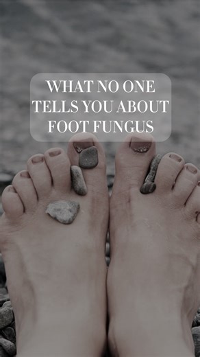 Madame Sweat on Instagram: "Here's what no one tells you about #footfungus!🦶Comment "sweat powder" below for more details!⬇️ #footfungustreatment #personalhygiene #bodyhygiene"