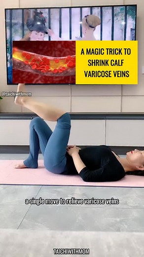 A MAGIC TRICK TO SHRINK CALF VARICOSE VEINS If your legs often feel heavy, swollen, or uncomfortable, try this simple daily movement. It supports better blood flow and helps your calves feel lighter day by day. #LegCare #VaricoseVeinsRelief #MiddleAgedHealth #CirculationBoost #GentleExercise | TaiChi With Mom