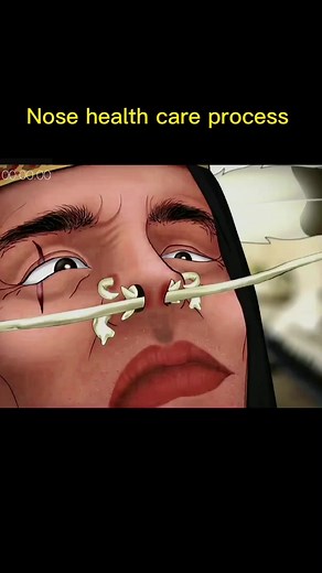 Nose Health Care Process: Piercing Aftercare Tips