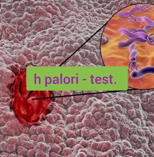 Phytoscience plant stem cells therapy. H,pylori treatment. #phytoscience #chronic #deasese #treatment