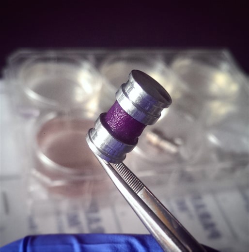 A tumour you can unroll: engineers create new technology for understanding cancer growth