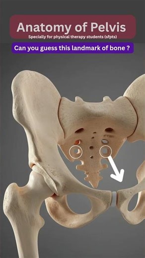 Can you guess this part of pelvis? Largest foramen in human body....anatomy of pelvis