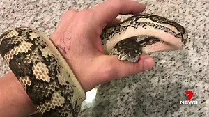 Woman experiences agonising pain from carpet python bite