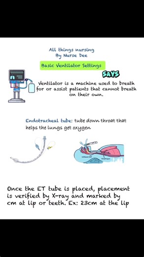 🔗 New ICU nurses, check link in bio Mechanical ventilation explained simple. 🫁 Breaking down ventilator settings, ET tube placement, FiO2, PEEP, tidal volume, SIMV vs AC mode, and what it all means for oxygenation and ventilation in the ICU. If you’re a new nurse learning vents and airway management, this is your quick critical care refresher. #icunurse #ICU #newgradnurse #studentnurses #nursingstudents | NurseDee Vlogs