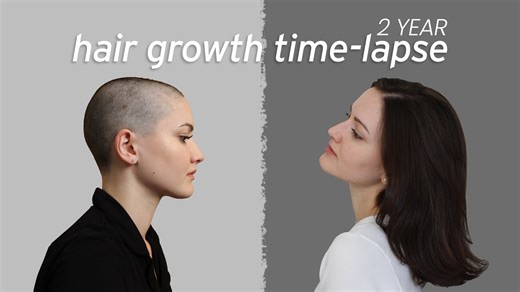 Hair growth time lapse