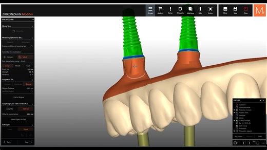 只要 10 分鐘！ 在 Zirkonzahn.Modifier 中，快速又輕鬆完成植體支撐式 Bar 的設計 精簡且智慧化的設計流程， 實現 高精度、高效率、100% 數位化 的 Bar 設計體驗 #崧達企業股份有限公司 #Zirkonzahn #ZirkonzahnItaly #數位牙科 | 崧達企業股份有限公司 Song Tah Trading Co Ltd