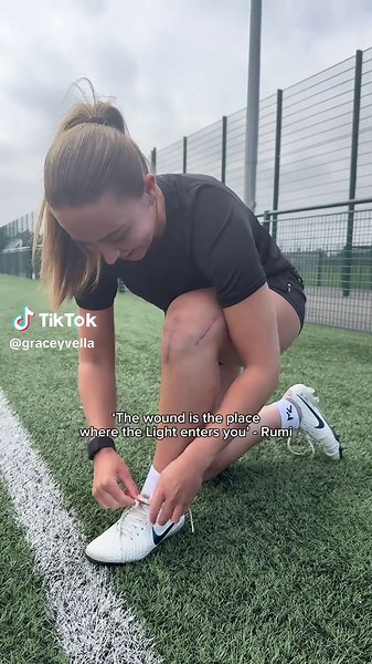 Embracing Your Scars: A Journey of ACL Recovery