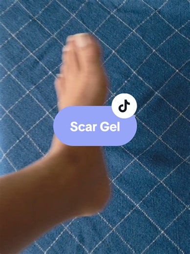 Effective Solutions for Scar Treatment