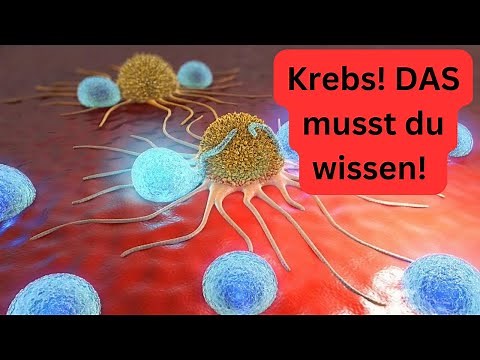 Diagnosis cancer! Development, causes and treatment!