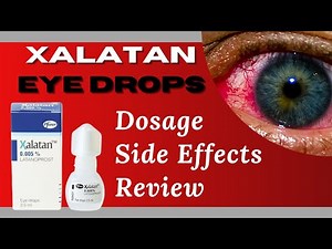 Glaucoma Management with Xalatan: A Complete Guide and Usage Instructions