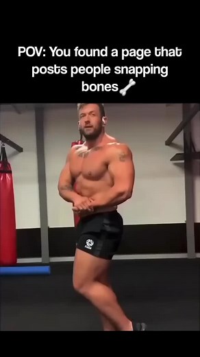 @peoplesnappingbones on Instagram: "Bodybuilder SNAPS his leg during posing 😵 #bonebreaking #bonebreak #breakingbones #brokenbones"