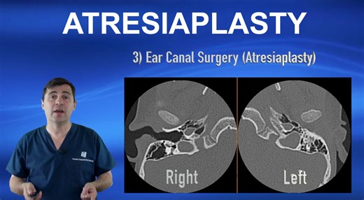 Atresiaplasty — Ear Canal Surgery for Microtia & Aural Atresia Explained by Dr. Bonilla