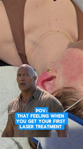 Understanding Sciton BBL Laser Treatment Benefits