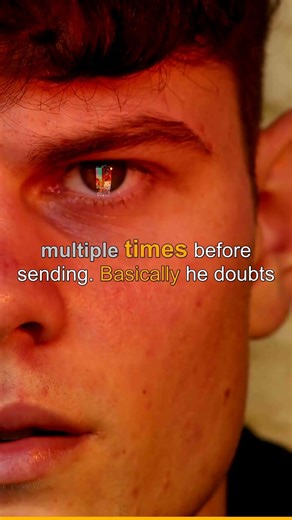 Claude's Source Code Got LEAKED! Shocking Truth Inside #Shorts