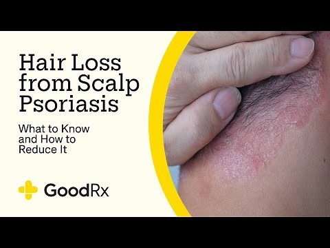 Hair Loss From Psoriasis on the Scalp: What to Know and What Helps | GoodRx