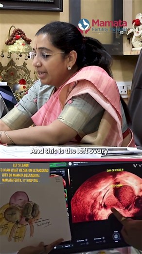 Why Does Endometriosis Cause So Much Pain? | Mamata Fertility Hospital: Hyderabad