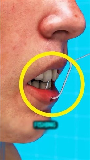 Don’t Pull It! Fish Hook Removal Trick 😱 #fishingtips #fishhook #shorts