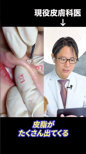 How to care for blackheads on the nose? A dermatologist explains #shorts