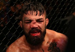 Mike Perry Undergoes Successful Surgery to Repair Disfigured Nose Following UFC Uruguay