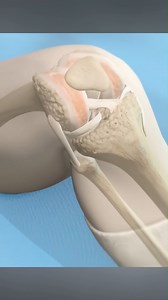 133K views · 734 reactions | Total knee step-by-step. #doctor #documentaryphotography #DoctorWho # reel # shorts #DoctorWh# | SMART Doctor | Facebook