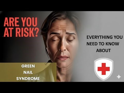 Green Nail Syndrome Explained Causes, Symptoms and Treatment, All Insights