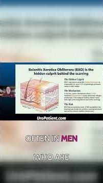 Balanitis Symptoms and Prevention: What Every Man Should Know