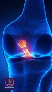 5.4K views · 34 reactions | ACL Injuries #reels #animation | Medical Animation Media | Facebook