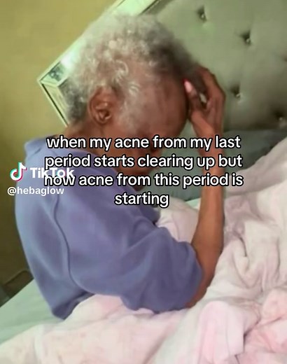 Acne After Period: Causes & Treatments