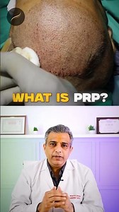 PRP Hair Loss Treatment? Full Explanation of Platelet-Rich Plasma Treatment & Its Benefits! #PRP