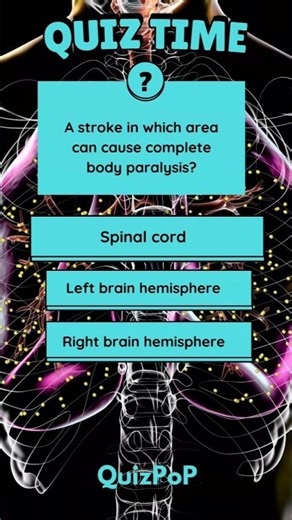 Body Paralysis Quiz#shorts#ytshorts #medicalquiz #quiztime #gkquiz