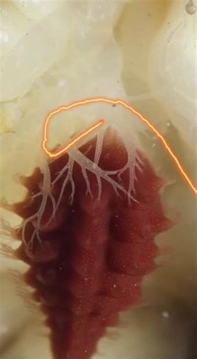 The Crab's Brain Gets Completely Taken Over #science #shorts #mindblown