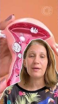🚨 Endometriose: o que é, principais sintomas e por que o diagnóstico demora tanto?