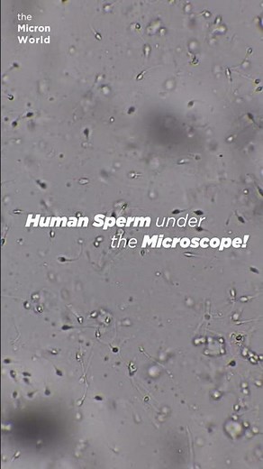 Human Sperm Under the Microscope (1000x) | Microscopic Life in Motion