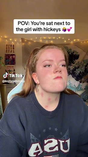 How to Give a Hickey: Tips from TikTok
