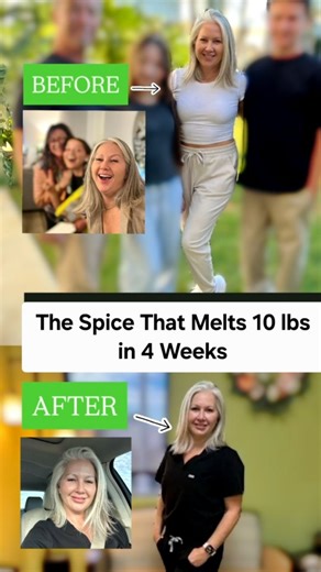 104K views · 388 reactions | Comment “TUMERIC” to get my Weight Loss...