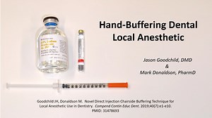 Video Demo: Buffering Dental Local Anesthesia By-Hand