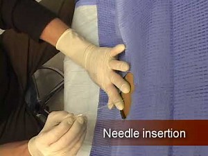 Lumbar Puncture Procedure Explained | Step-by-Step Spinal Tap Technique