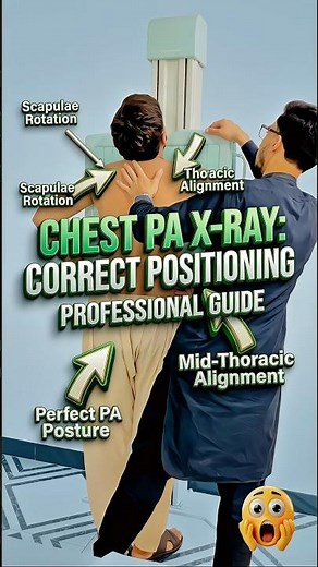 How To Perform Chest PA X-RAY Positioning #drnakash2001