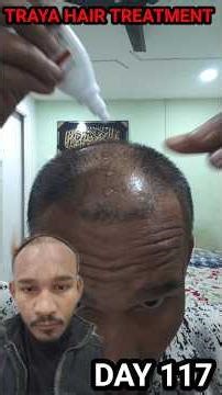 22 January Update | Mere Upar TRAYA Kaam Nahi Kiya