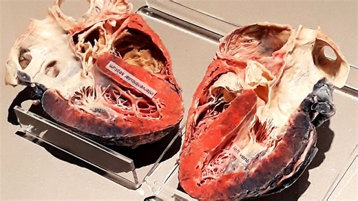 China's ‘ionic glass’ method turns brains and hearts transparent