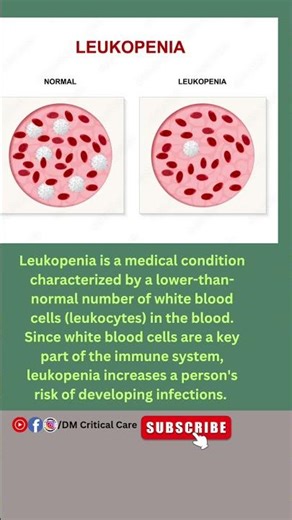 Leukopenia|Decrease of Leukocytes|Lower WBC Cells|Blood Disease #leukopenia #wbc #blooddisorder