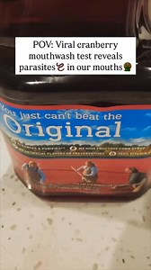 PARASITES 🪱 AND GUM DISEASE: "Currently, studies have shown that the primary parasites linked to periodontal diseases are Entamoeba gingivalis, Trichomonas tenax, and T. gondii (15, 16). The interaction between the oral microbiome and T. gondii could contribute to the development and progression of periodontal diseases including periodontitis." T. Gondii is toxoplasma gondii, the parasite you get from CATS that is estimated to have infected 1/3 of Americans. Parasites can infect and burrow ANYW