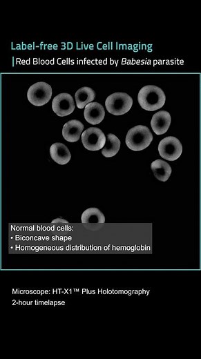 Red blood cells and Babesiosis - Label-free 3D live cell imaging