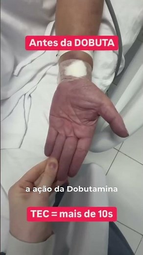 How to assess the action of dobutamine in a patient with cardiogenic shock?