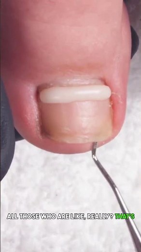 toe jam treasure #nailtech #pedicure #feet