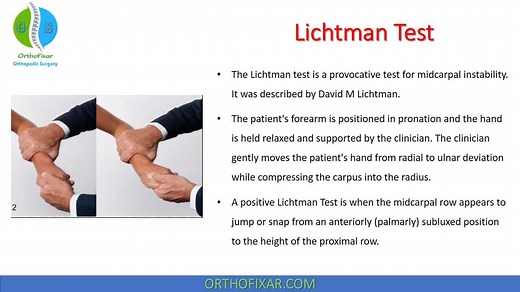 Lichtman Test For Midcarpal Instability