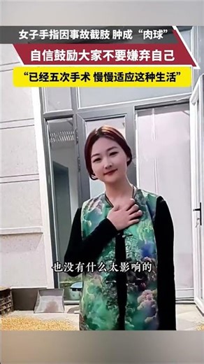 Her finger was amputated in an accident and swelled up into a "fleshy ball." She confidently enco...