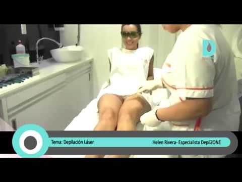 Depilación Láser