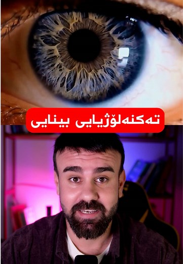 First Bionic Eye Developed by Kurds