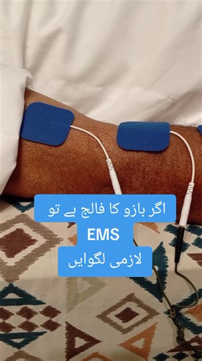 Effective EMS Treatment for Arm Paralysis Recovery